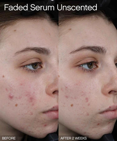 Faded Brightening + Clearing Serum (Unscented)